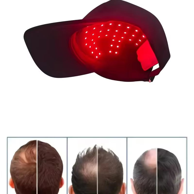 Lightweight LED Scalp Care Cap, Perfect for Travel and Daily Scalp Nourishment Needs Health Cap